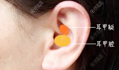 耳软骨隆鼻取骨部位—耳甲腔
