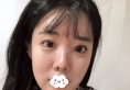 韩国留学生谈找玛博尔徐逸范做隆鼻垫下巴手术的原因及术后效果