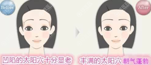 ̫Ѩôƺ