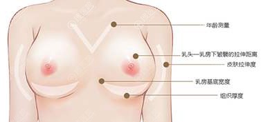 假体隆胸前设计标准