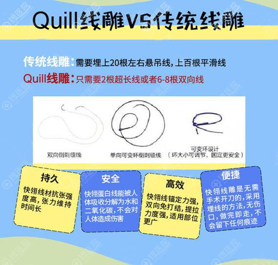 美国快翎线和普通线的区别