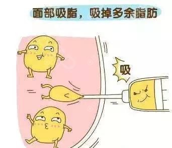 面部吸脂不带头套会怎么样？