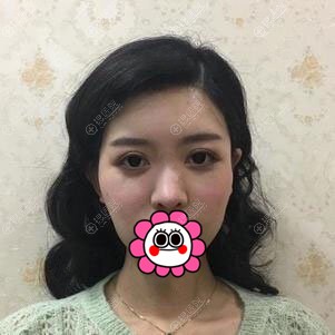 ֬沿ǰ