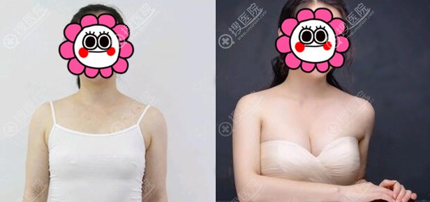 姐姐解内衣_美女被绑解内衣(3)