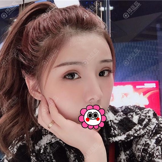 컪¿˫Ƥ