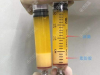 谁做过脂肪胶填充效果怎样?说脂肪胶填充一个星期还是肿正常吗