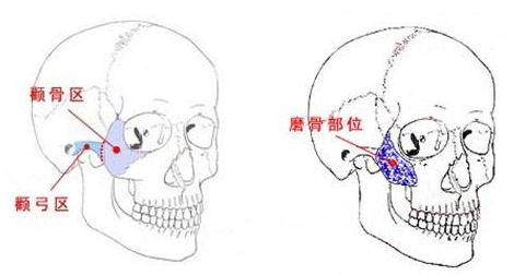 後悔 脂肪 吸引